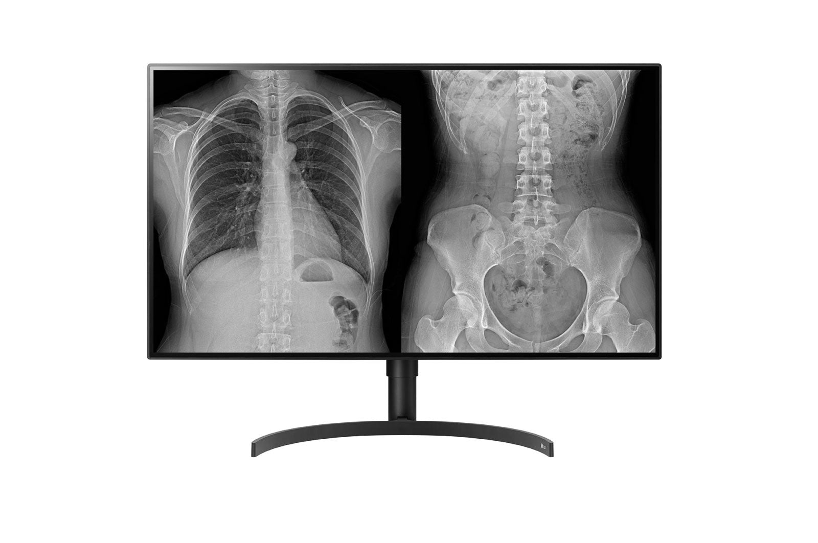 LG 32HL512D-B écran plat de PC 80 cm (31.5") 3840 x 2160 pixels Full HD Noir